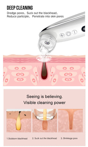 Image of Electric Visual Blackhead Facial Care