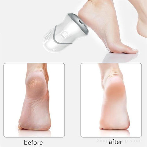 Image of USB Charging Electric Foot Massager.