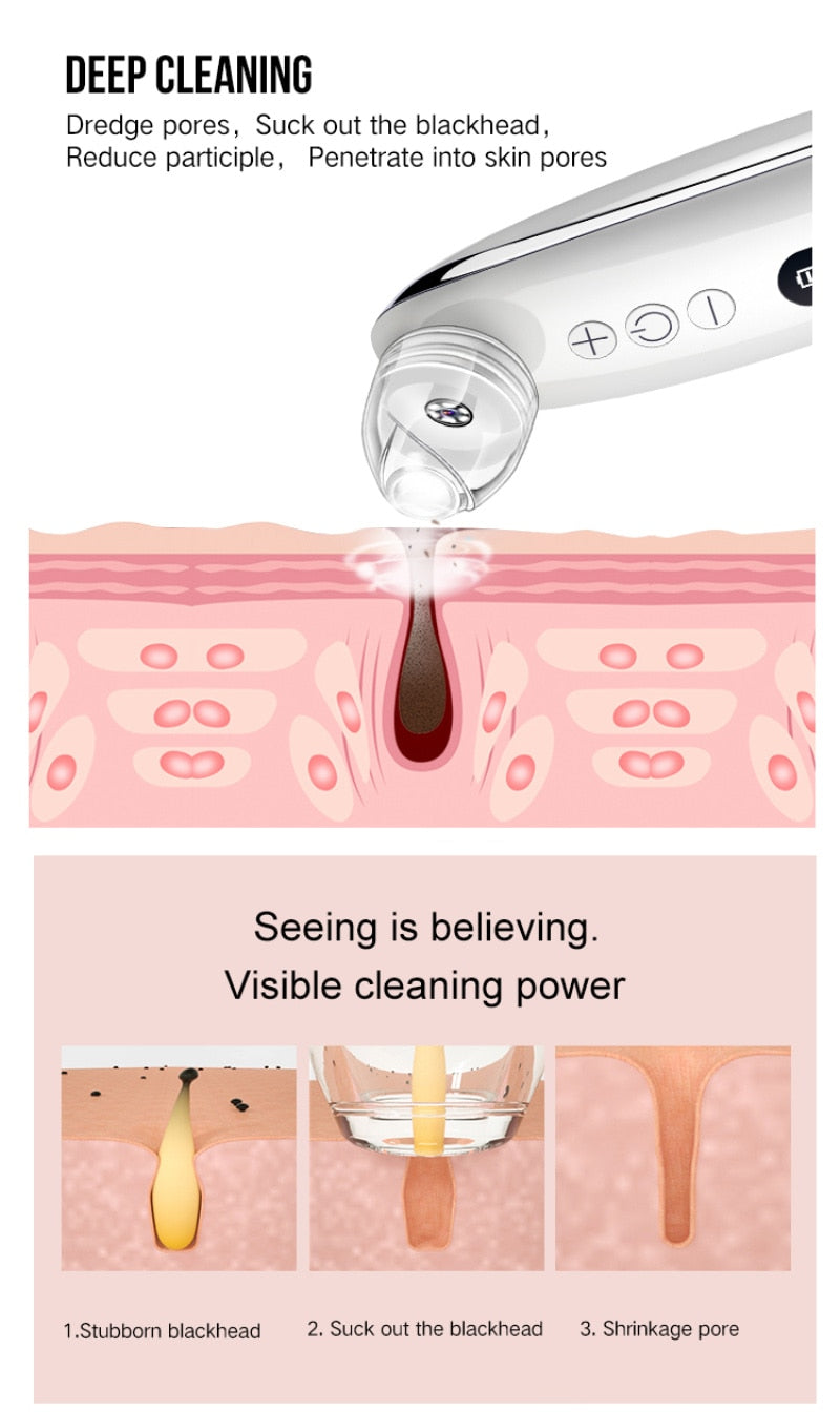 Electric Visual Blackhead Facial Care