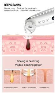 Electric Visual Blackhead Facial Care